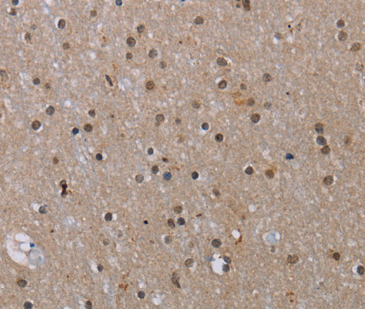 MED12 Polyclonal Antibody (E-AB-16671)