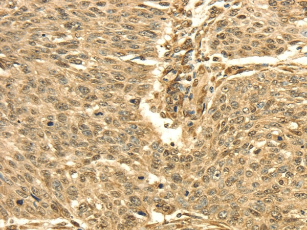 SEPT2 Polyclonal Antibody (E-AB-17022)