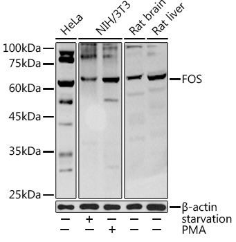 FOS Polyclonal Antibody (E-AB-93208)