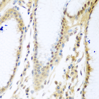 MYBBP1A Polyclonal Antibody (E-AB-62349)