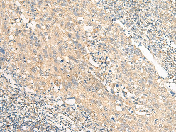 CHP1 Polyclonal Antibody (E-AB-18023)