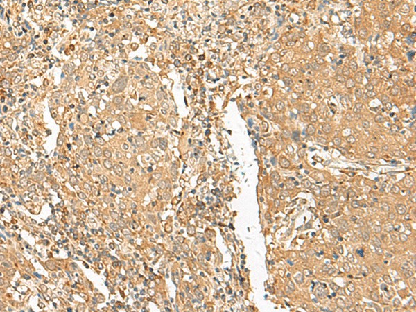 GOLGA6A Polyclonal Antibody (E-AB-18011)