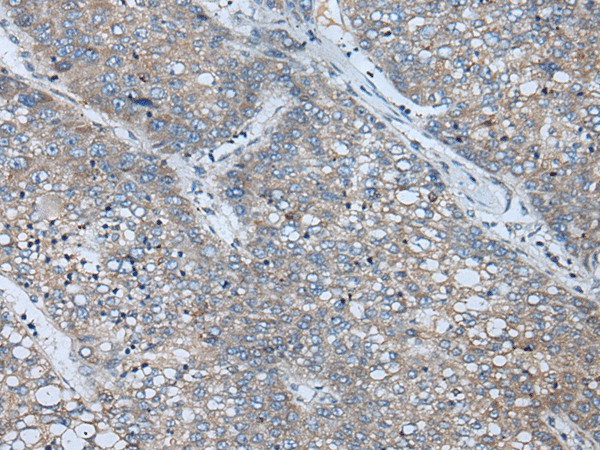 BICD2 Polyclonal Antibody (E-AB-53598)