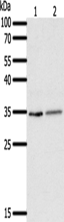 SFTPA1 Polyclonal Antibody (E-AB-12880)