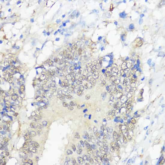 GPX2 Polyclonal Antibody (E-AB-66645)