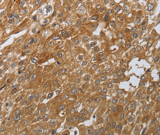 PTPRM Polyclonal Antibody (E-AB-16045)