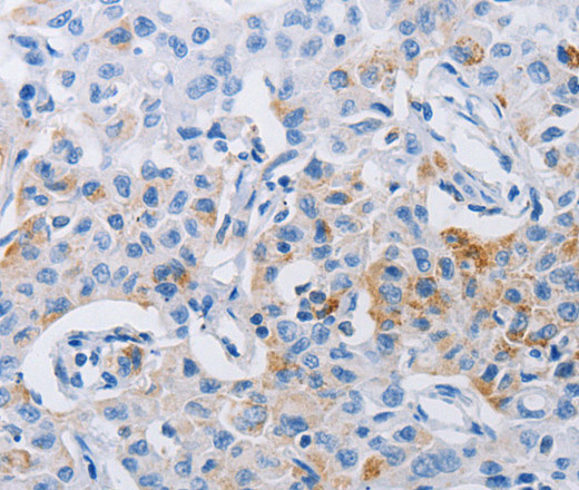 LRIG1 Polyclonal Antibody (E-AB-12544)
