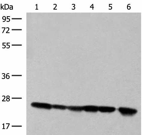 DTYMK Polyclonal Antibody (E-AB-52710)