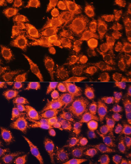 AMPKa1/AMPKa2 Polyclonal Antibody (E-AB-65955)