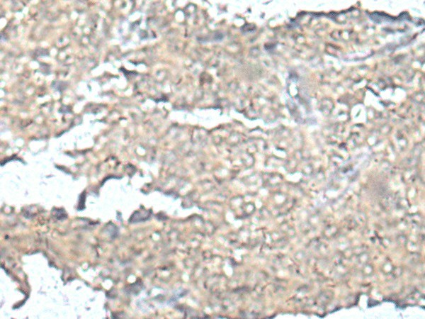 MEF2D Polyclonal Antibody (E-AB-53508)