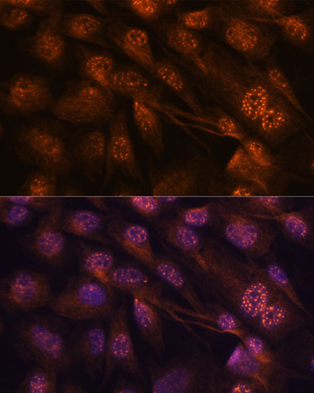 (KO Validated) MAP2K7 Polyclonal Antibody (E-AB-60668)