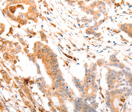 ABCA4 Polyclonal Antibody (E-AB-12935)
