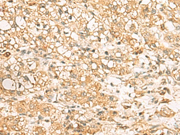 USP24 Polyclonal Antibody (E-AB-53582)