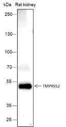 Recombinant TMPRSS2 Monoclonal Antibody (AN301677L)