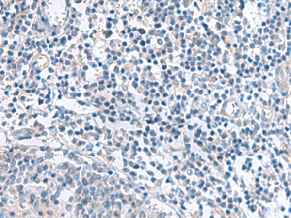 MYL1 Polyclonal Antibody (E-AB-19129)