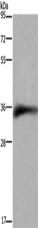 CD32 Polyclonal Antibody (E-AB-11226)