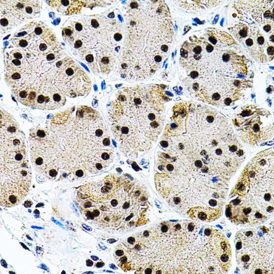 EIF4G2 Polyclonal Antibody (E-AB-60796)