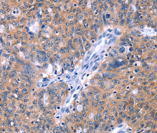 ZNF395 Polyclonal Antibody (E-AB-13288)