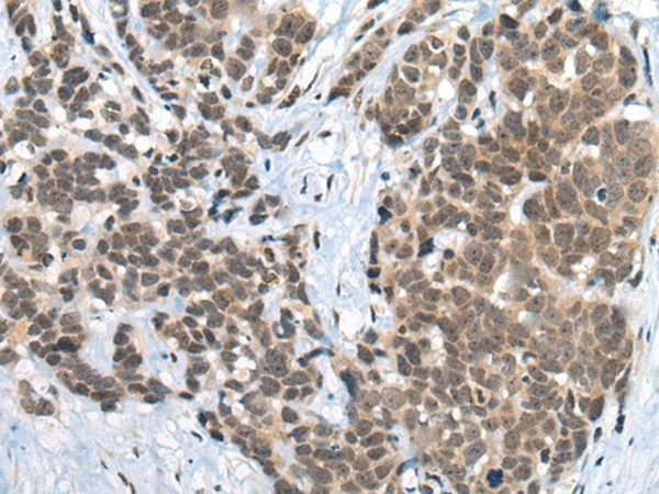ZNF83 Polyclonal Antibody (E-AB-52396)