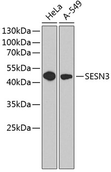 SESN3 Polyclonal Antibody (E-AB-63213)