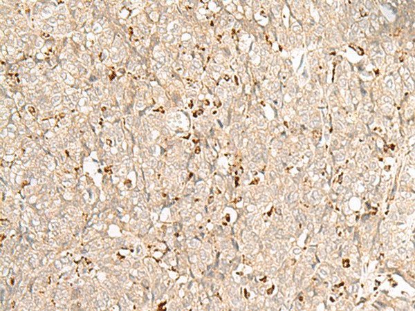 NUP210 Polyclonal Antibody (E-AB-18012)