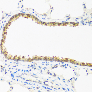 CDKN2C Polyclonal Antibody (E-AB-61784)