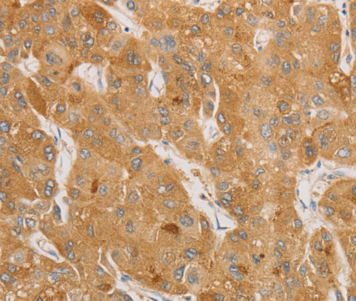 NGF Polyclonal Antibody (E-AB-10487)