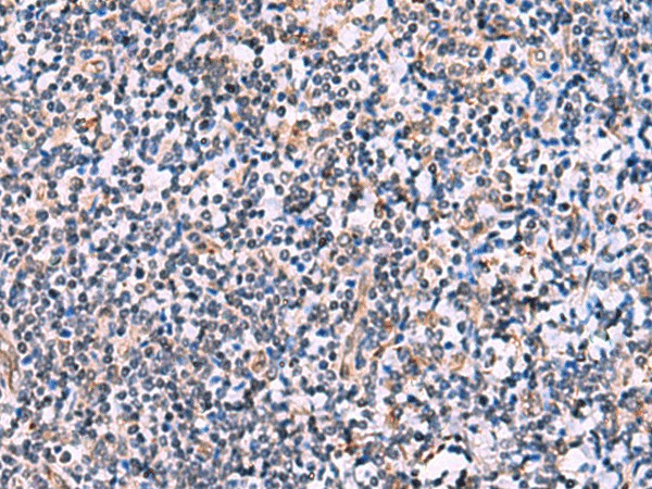 NMRK2 Polyclonal Antibody (E-AB-18137)