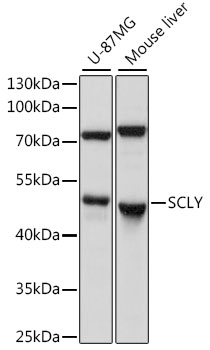 SCLY Polyclonal Antibody (E-AB-91308)