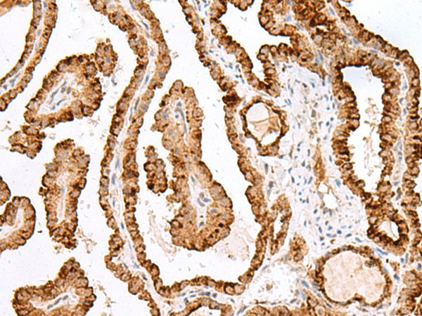 SAXO2 Polyclonal Antibody (E-AB-17940)