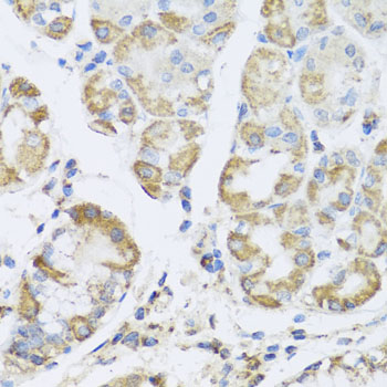 PRKAG1 Polyclonal Antibody (E-AB-61632)