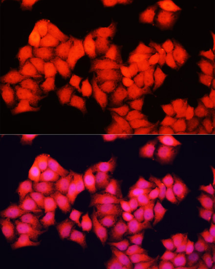 ARAF Polyclonal Antibody (E-AB-66772)