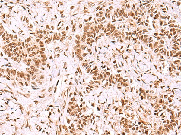 GPKOW Polyclonal Antibody (E-AB-52972)