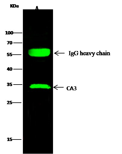 Recombinant Carbonic Anhydrase III/CA3 Monoclonal Antibody (AN300193P)