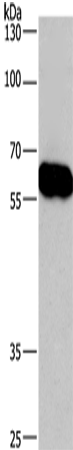 CORO1C Polyclonal Antibody (E-AB-11096)