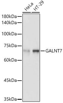 GALNT7 Polyclonal Antibody (E-AB-92209)