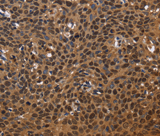 EXTL3 Polyclonal Antibody (E-AB-15003)