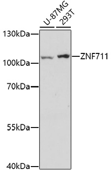 ZNF711 Polyclonal Antibody (E-AB-67019)