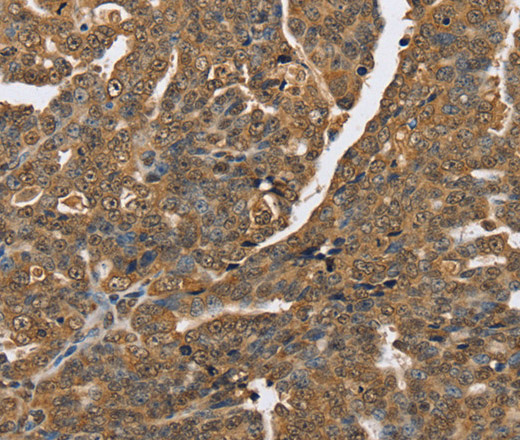 PTPN20 Polyclonal Antibody (E-AB-13542)