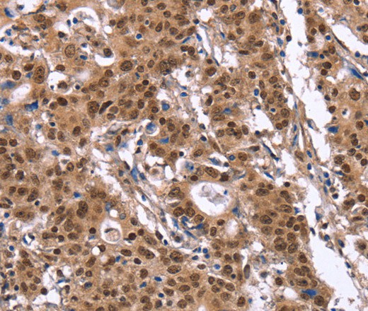 ID4 Polyclonal Antibody (E-AB-16503)