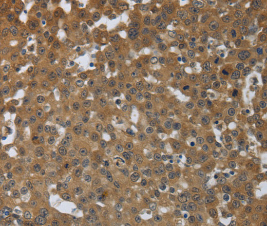 PTPRM Polyclonal Antibody (E-AB-12853)