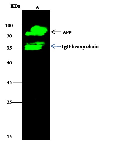 Recombinant AFP/alpha-fetoprotein Monoclonal Antibody (AN300030P)