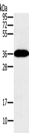 PPP1CC Polyclonal Antibody (E-AB-13531)