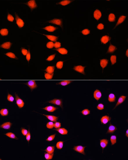 COMMD1 Polyclonal Antibody (E-AB-61556)