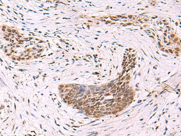 CREBBP Polyclonal Antibody (E-AB-52070)