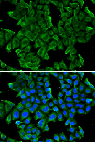 REG3G Polyclonal Antibody (E-AB-60637)