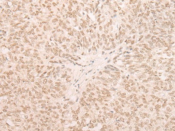 EIF4A3 Polyclonal Antibody (E-AB-52632)