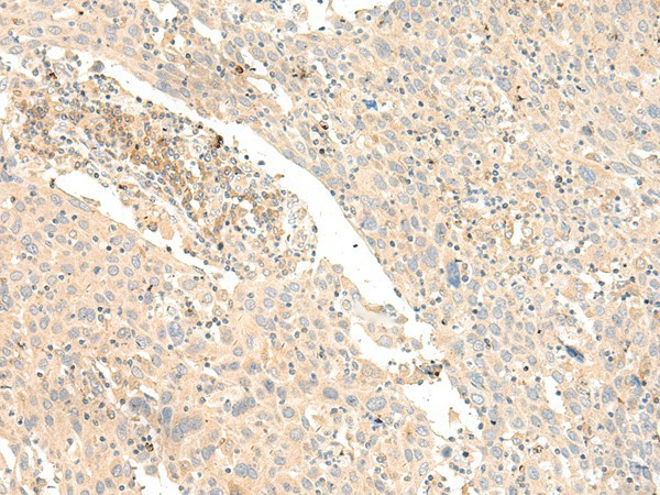 GLIS1 Polyclonal Antibody (E-AB-19911)