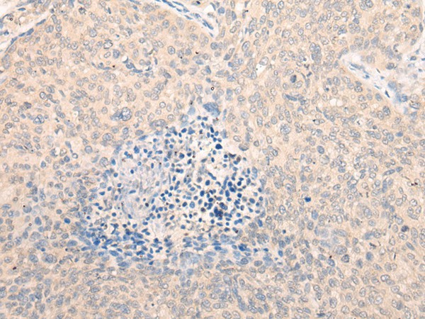 SEPT10 Polyclonal Antibody (E-AB-52641)