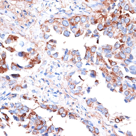 TIM-3/HAVCR2 Polyclonal Antibody (E-AB-60706)
